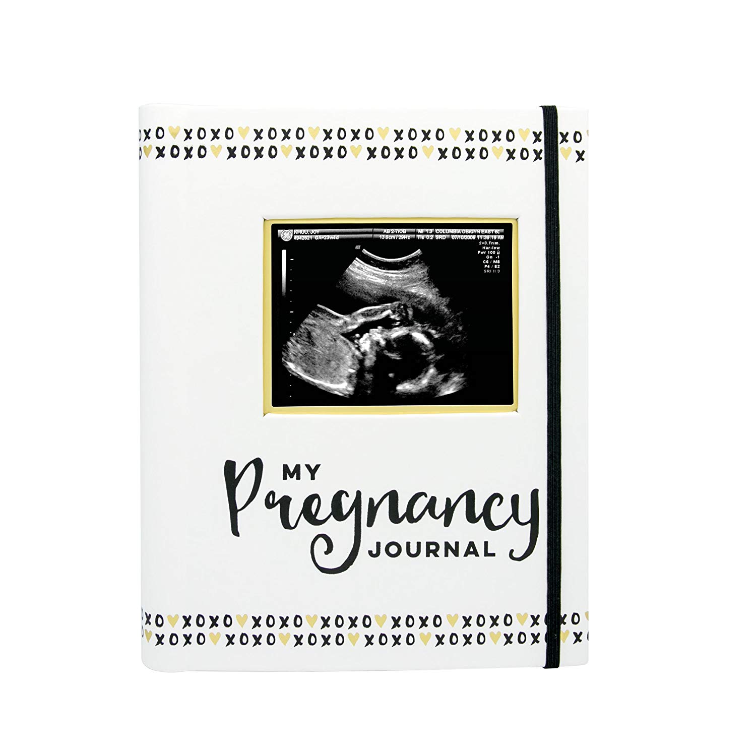 Pearhead My Pregnancy Journal, Pregnancy Keepsake Book, Pregnancy Milestone Memories and Photo Album