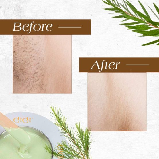 GiGi Tea Tree Cream Wax A Soothing Hair Removal Formula 396g - Image 3