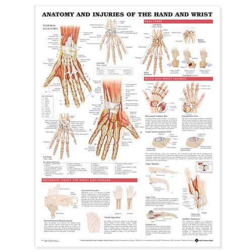 Anatomy and Injury Of Hand And Wrist Anatomical Chart, white, Medium
