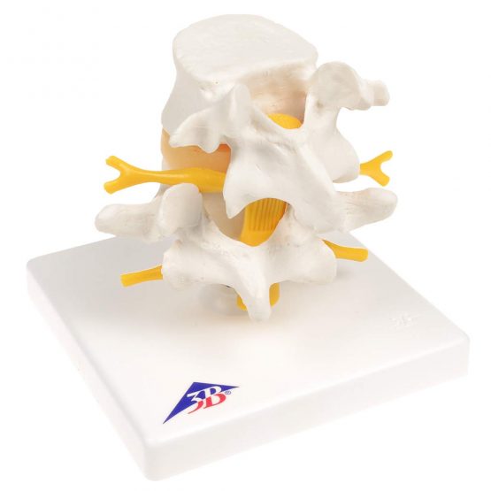 3B Scientific Lumbar Spinal Column with Prolapsed InterVertebral Disc + free anatomy software - 3B Smart Anatomy - Image 3