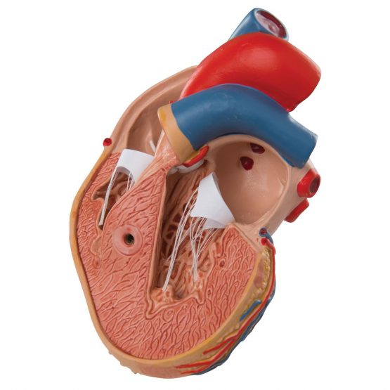 3B Scientific Human Anatomy - Classic Heart Model with Left Ventricular Hypertrophy, 2 Part + free anatomy software - 3B Smart Anatomy - Image 2