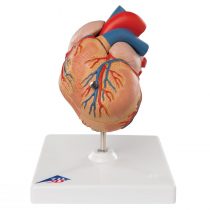 3B Scientific Human Anatomy - Classic Heart Model with Left Ventricular Hypertrophy, 2 Part + free anatomy software - 3B Smart Anatomy
