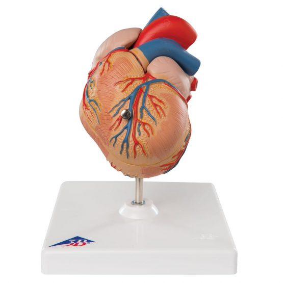 3B Scientific Human Anatomy - Classic Heart Model with Left Ventricular Hypertrophy, 2 Part + free anatomy software - 3B Smart Anatomy