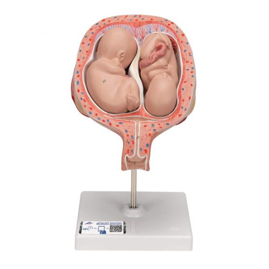 3B Scientific L10/7 5th Month Twin Foetuses', Normal Position + free anatomy software - 3B Smart Anatomy