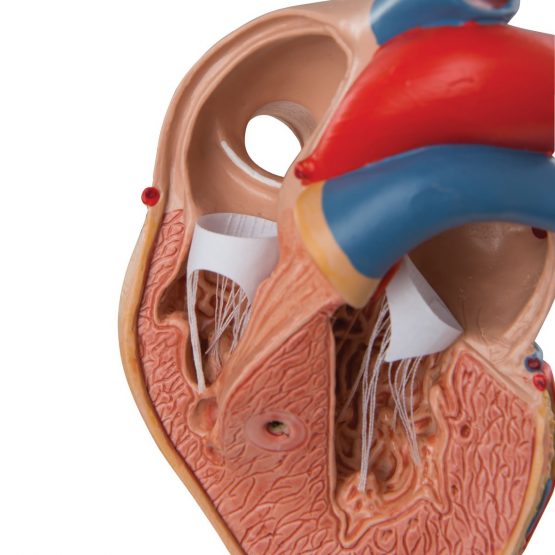 3B Scientific Human Anatomy - Classic Heart Model with Left Ventricular Hypertrophy, 2 Part + free anatomy software - 3B Smart Anatomy - Image 3