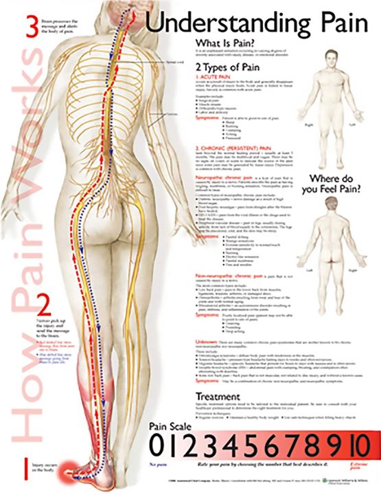 Understanding Pain Anatomical Chart