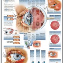 3B Scientific VR1231UU Human Anatomy - Diseases of the Eye Chart, Paper Version, unlaminated