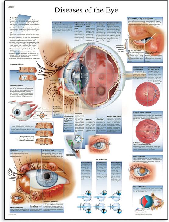 3B Scientific VR1231UU Human Anatomy - Diseases of the Eye Chart, Paper Version, unlaminated