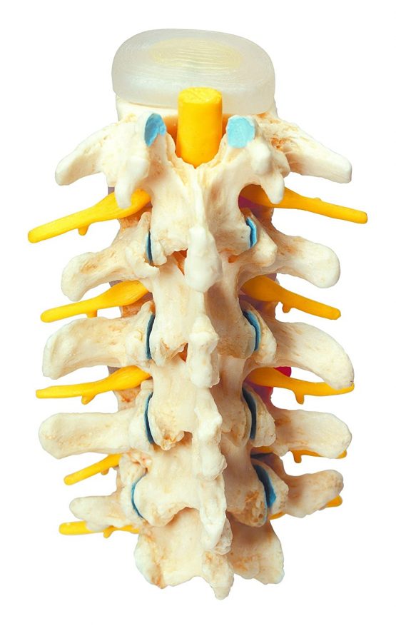3B Scientific Stages of Disc prolapse and Vertebral Degeneration + free anatomy software - 3B Smart Anatomy A795 - Image 3