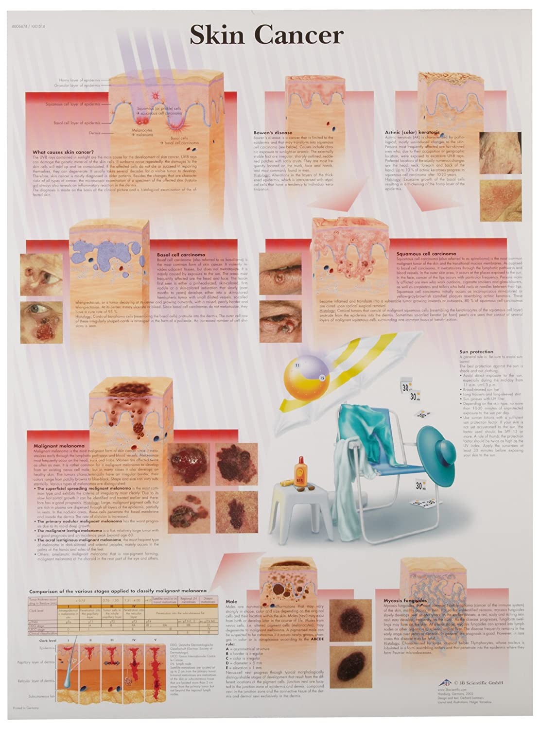 3B Scientific Human Anatomy – Skin Cancer Chart, Paper Version – BigaMart