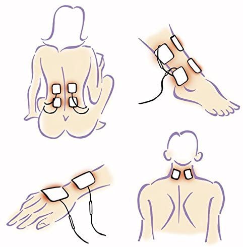 E-Cron Compatible TENS Pads, Electrodes 5 cm, Snap connection, Long Lasting, Self-Adhesive and Reusable Electrode Pads - Image 3