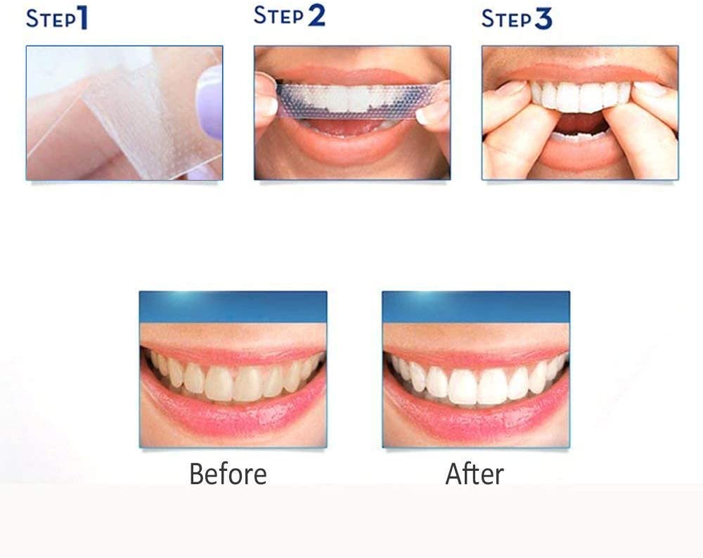 Aiooy Teeth Whitening Strips, Dental Enamel Safe Teeth Bleaching