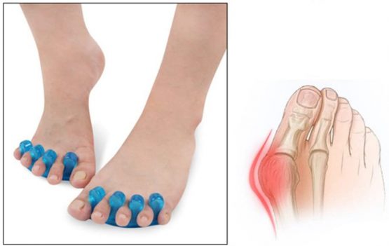 2 Pair Gel Toe Stretcher and Toe Separator for Relaxing Toes, Bunion Relief, Hammer Toe and more for Women and Men, Quickly Alleviating Pain After Yoga and Sports Activities - Image 4
