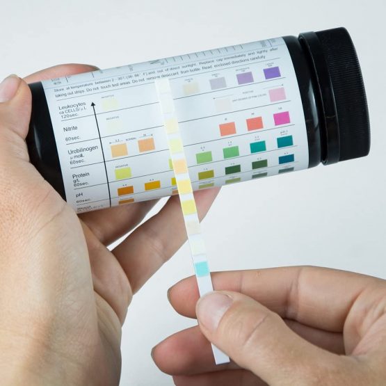 Yercon Urine Infection Test 10 Parameter Urine Dip Test (100 Test Strips per Pack) - Image 2