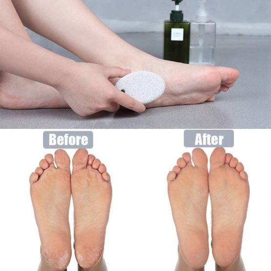 Pumice Stone 2Pcs, Natural Lava Pumice Stone for Feet/Hands/Body, White Calluse Remover/Foot Scrubber Stone for Dead/Hard Skin, Foot File for Men/Women by MAYKI - Image 4