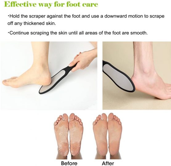 BEZOX Professional Foot File, Double Side Pedicure Rasp, Dead Hard Cracked Skin Calluses Remover, Portable Foot Care Tool, Heavy Duty Stainless Steel (Soft Silicone Handle) - Image 4