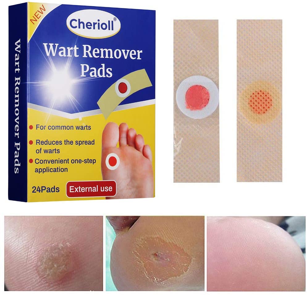 Wart Remover, Wart Removal Plasters Pad, Foot Corn Removal Plaster with ...