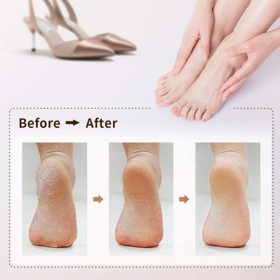 Electric Foot File, DIOZO Rechargeable Waterproof Hard Skin Remover with 3 Rollers and 2 speeds, Remove Cracked Heels and Dead Skin Within Minutes - Image 4