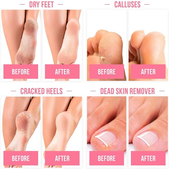 Foot Peel Mask with Strawberry by Plantifique - 2 Pack Foot Mask Dermatologically Tested - Repair Heels & Removes Dry Dead Skin for Soft Baby Feet - Exfoliating Foot Peel Mask for Hard Skin - Peeling - Image 4