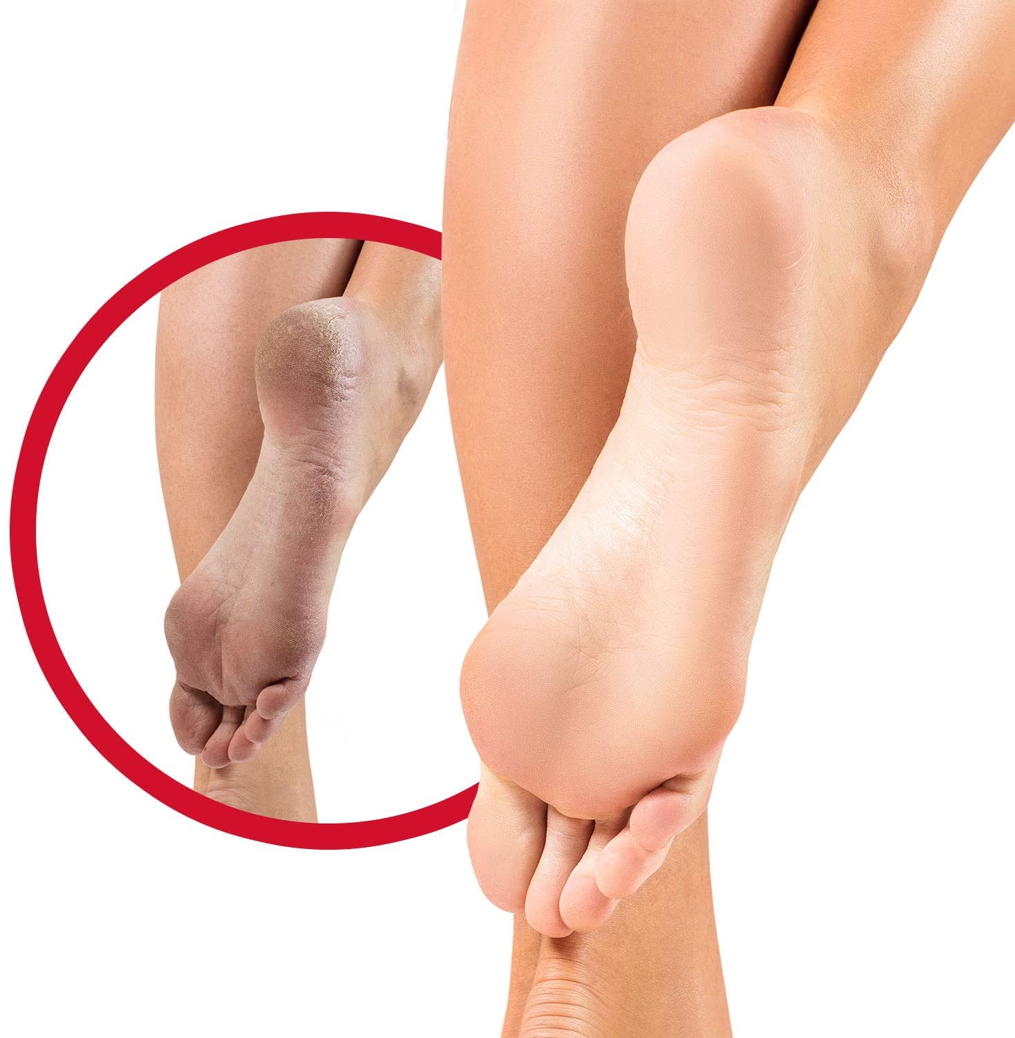 Flexitol Hard Skin and Callus Balm, Exfoliating Foot Balm, Suitable for Diabetics - 56 g - Image 3
