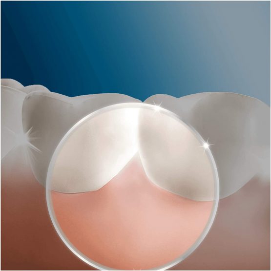 Oral-B OxyJet cleaning system, with micro air bubble technology, 4 push-on nozzles - Image 3