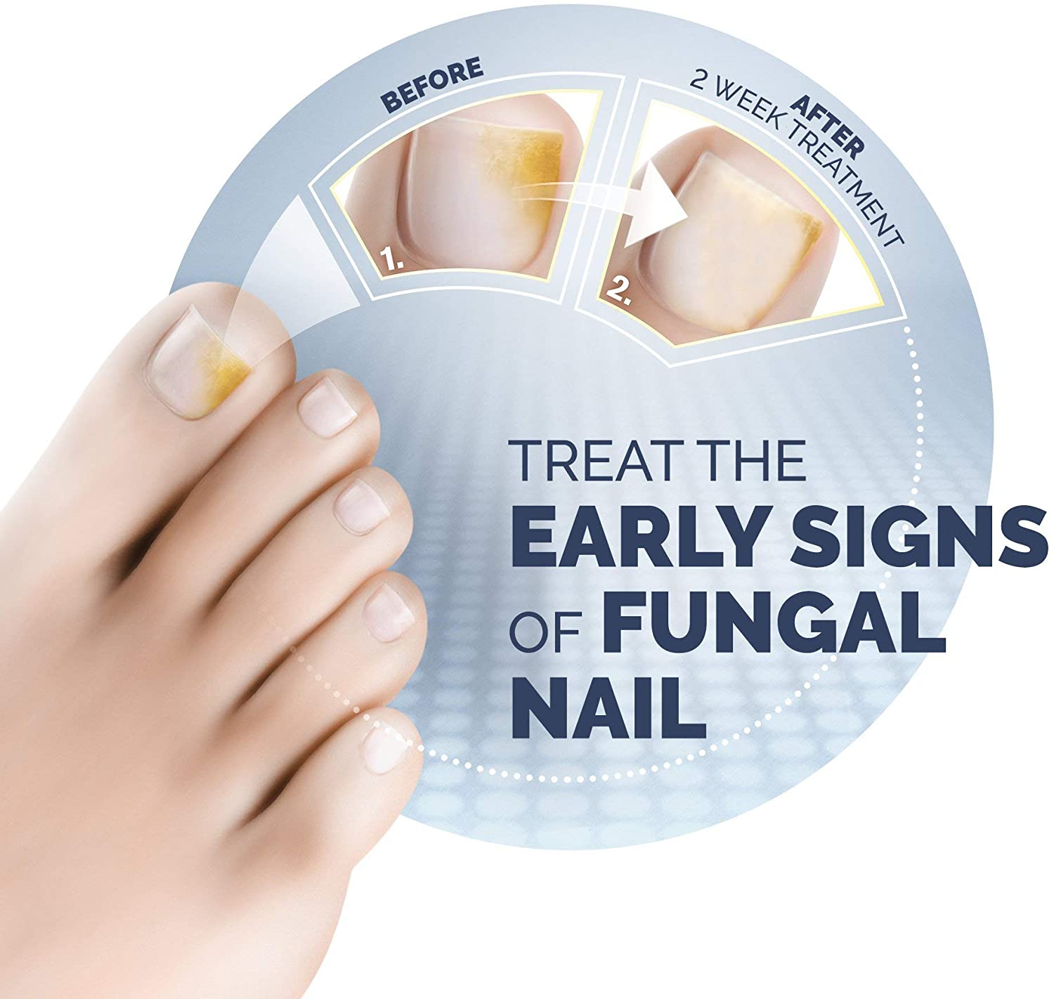 Scholl Fungal Nail Treatment 3.8ml,packaging may vary, Blanco - Image 3