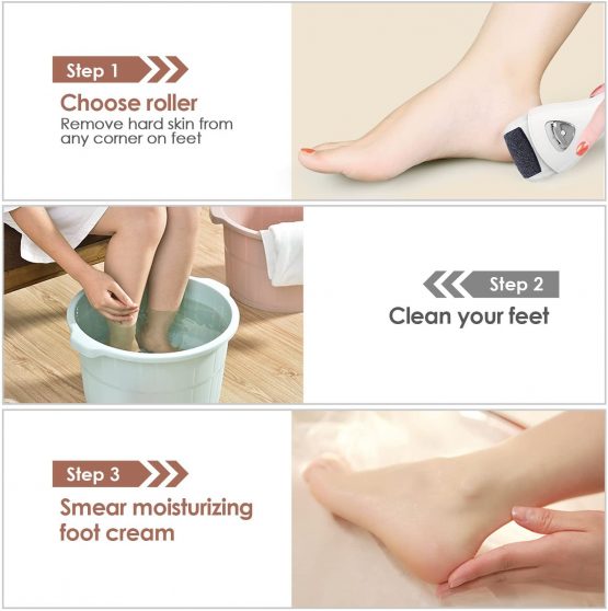 Hard Skin Remover, MYCARBON Electric Foot File Rechargeable Callus Remover Pedicure Tools with 2 Speeds&3 Rollers for Foot Care - Image 3
