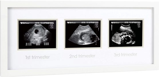 Pearhead Pregnancy Belly Casting Kit, Pregnancy Announcement Gifts, Cherish your Pregnancy, White - Image 2