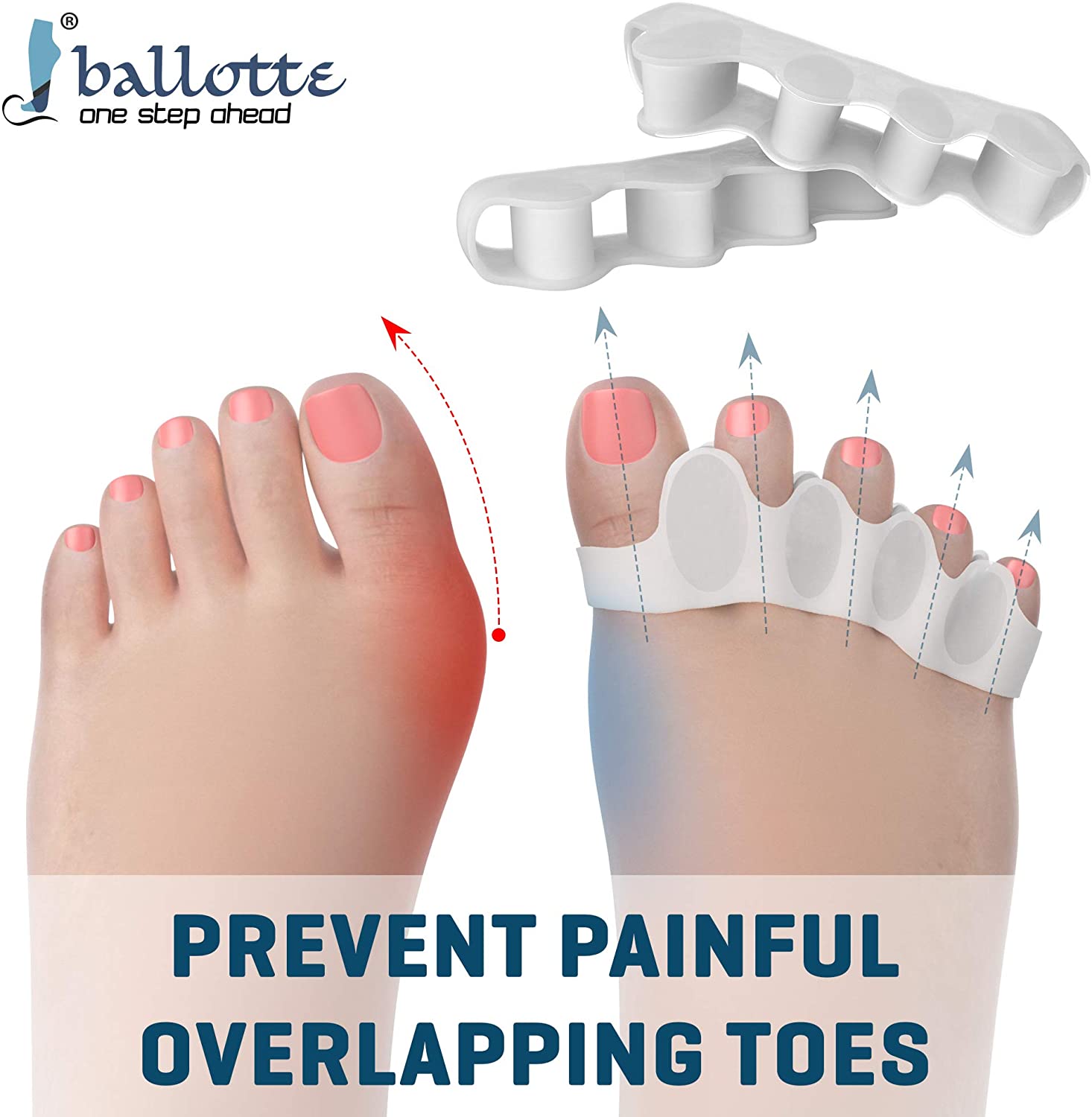 Toe Separators for Overlapping Toes, Toe Spacers Soft and Gentle