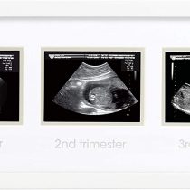 Pearhead Pregnancy Belly Casting Kit, Pregnancy Announcement Gifts, Cherish your Pregnancy, White
