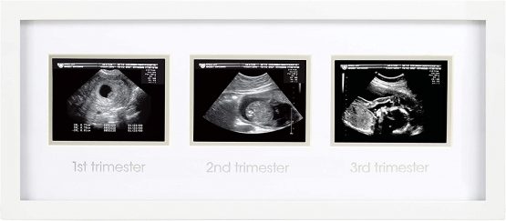 Pearhead Pregnancy Belly Casting Kit, Pregnancy Announcement Gifts, Cherish your Pregnancy, White