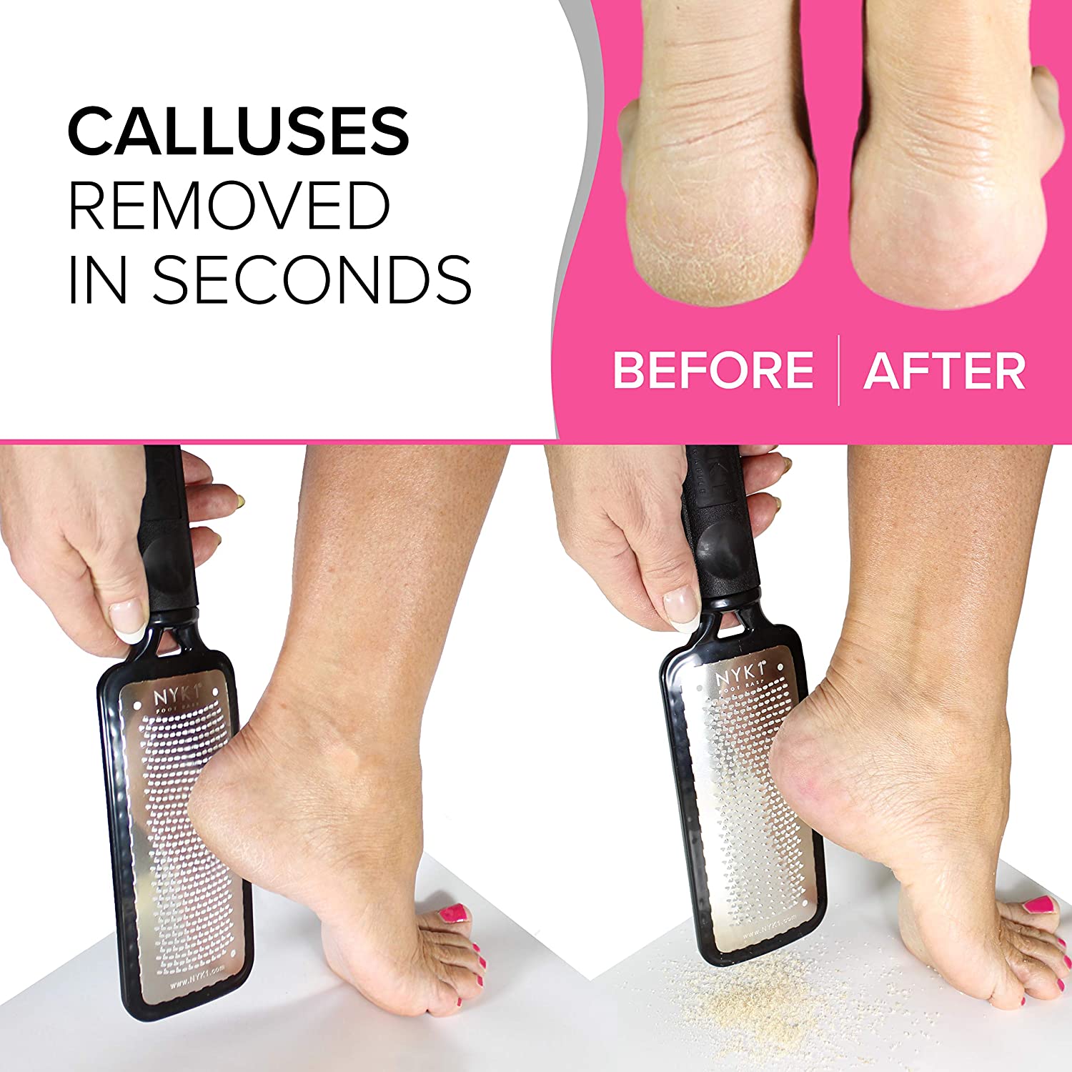 RUSTPROOF Foot File Callus Remover for Feet with Catcher (XL Size) NYK1 MEGAFILE Foot Files for Hard Skin Remover for Wet & Dry Use - Image 2