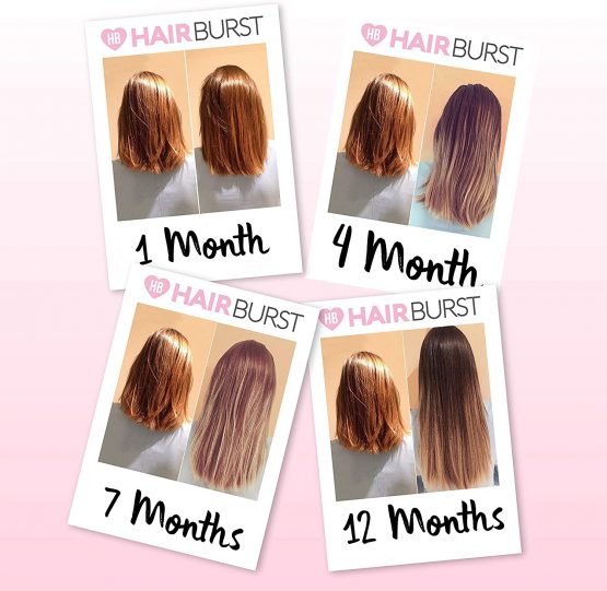 Hair Growth Shampoo & Conditioner Set For Women - Best Vegan Shampoo for Anti Hair Loss & Thinning Hair - Healthy Hair Growth Boost - Grow Gorgeous Longer Hair - Hair Thickening Products by Hairburst - Image 3
