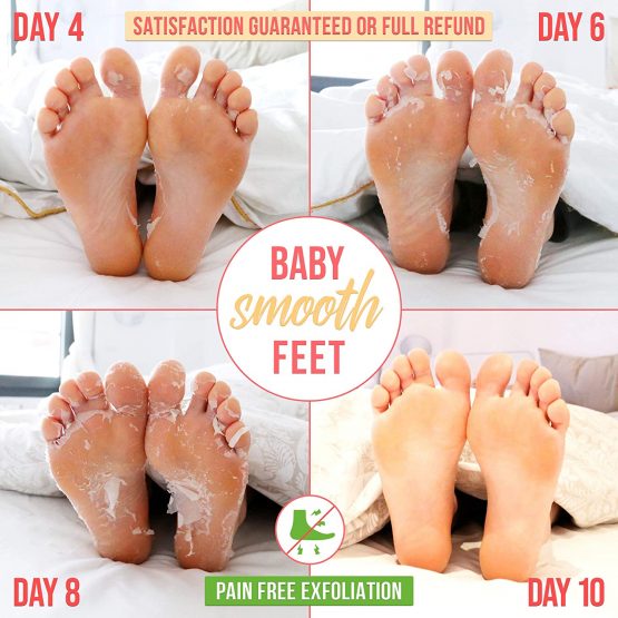 Foot Peel Mask with Strawberry by Plantifique - 2 Pack Foot Mask Dermatologically Tested - Repair Heels & Removes Dry Dead Skin for Soft Baby Feet - Exfoliating Foot Peel Mask for Hard Skin - Peeling - Image 3