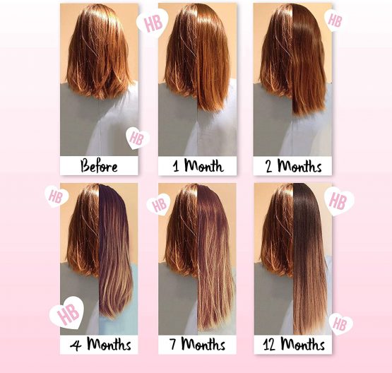 Hair Growth Shampoo & Conditioner Set For Women - Best Vegan Shampoo for Anti Hair Loss & Thinning Hair - Healthy Hair Growth Boost - Grow Gorgeous Longer Hair - Hair Thickening Products by Hairburst - Image 4
