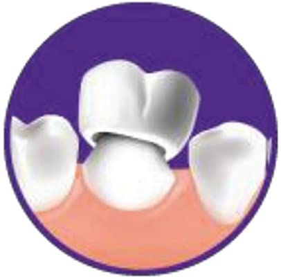 DenTek Dentek Essentials Filling Material, White, 1 Count (Pack of 1) - Image 3