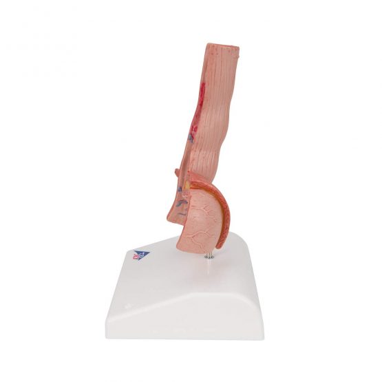 3B Scientific K18 Diseases of The Oesophagus + free anatomy software - 3B Smart Anatomy - Image 3