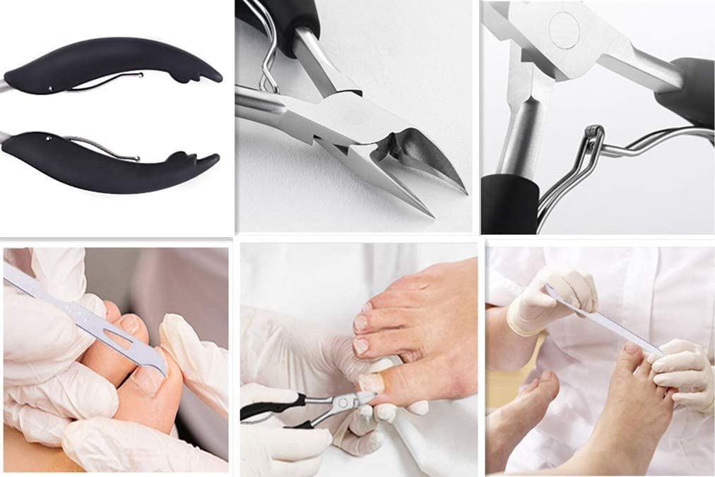 ingrown toenail clipper ingrown toenail clipper