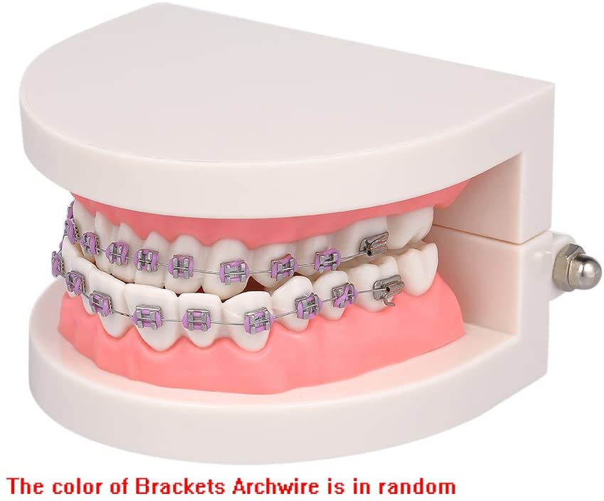 Anself Orthodontic Model Dental Teeth Standard Demonstration with ...