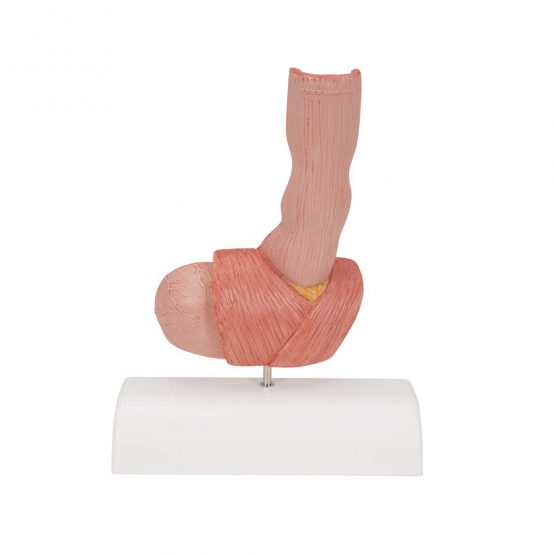 3B Scientific K18 Diseases of The Oesophagus + free anatomy software - 3B Smart Anatomy - Image 4