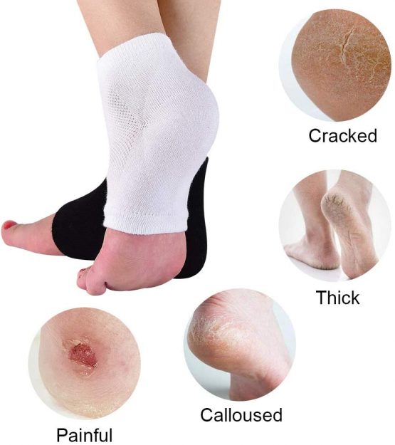 Moisturizing Socks,3 Pairs Soft Ventilate Gel Heel Socks Open Toe Socks for Dry Hard Cracked Skin Moisturizing Day Night Care Skin (Black, Regular Size) - Image 2