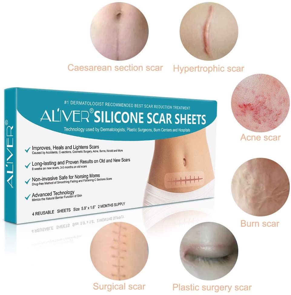 Silicone Scar Removal Sheets, Professional Gel Scar Repair Treatment