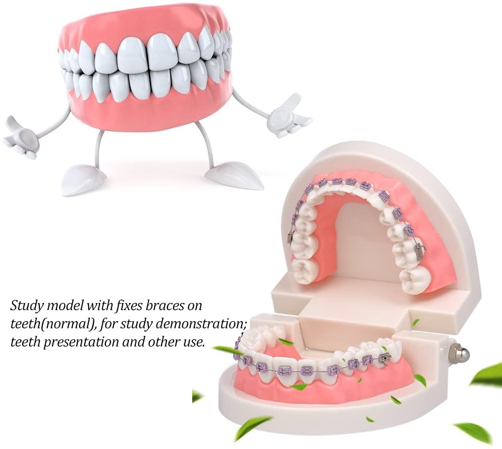 Anself Orthodontic Model Dental Teeth Standard Demonstration with ...