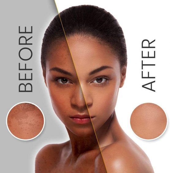 Bio Chear + Skin Lightening Shower Gel 750ml - for bright & hygienic skin - with vitamin c - Image 2