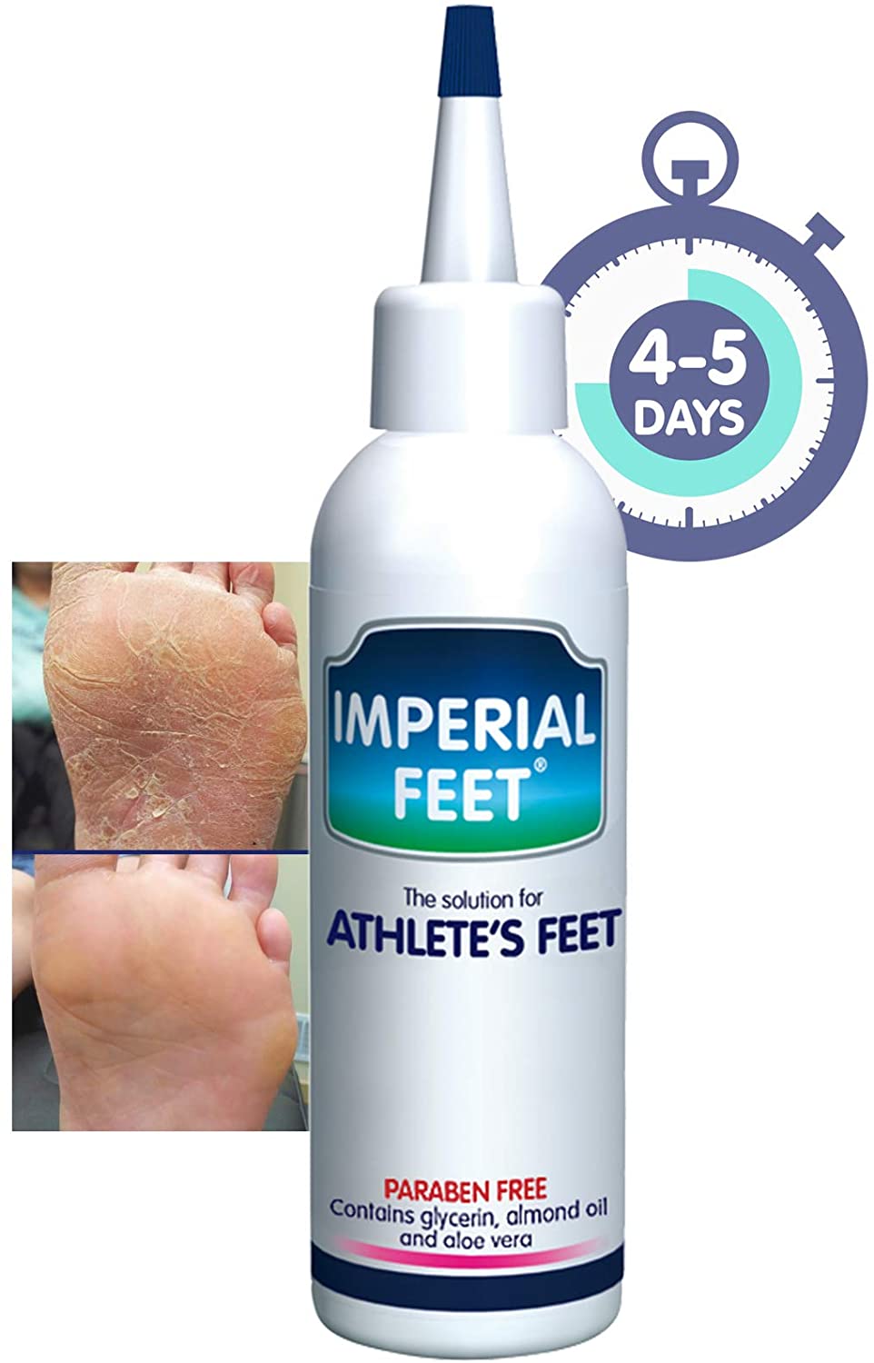 Imperial Feet Foot Cream XL - Natural Foot Care Formula, 75 ML for Cracked and Flaky Skin - Soothes, and Protects Feet Naturally