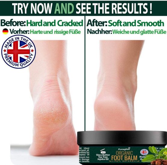 Organic Foot Balm by NatriGlo -Puregliss 200g for Dry Feet, Cracked Heels, Hard Skin, Sore Feet, Fungus & More, 100% Natural Treatment Foot Cream Moisturiser with Tea Tree Oil-Shea Butter-Jojoba Oil - Image 3