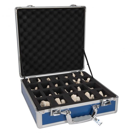 3B Scientific Set of 24 Bonelike Vertebrae + free anatomy software - 3B Smart Anatomy A793