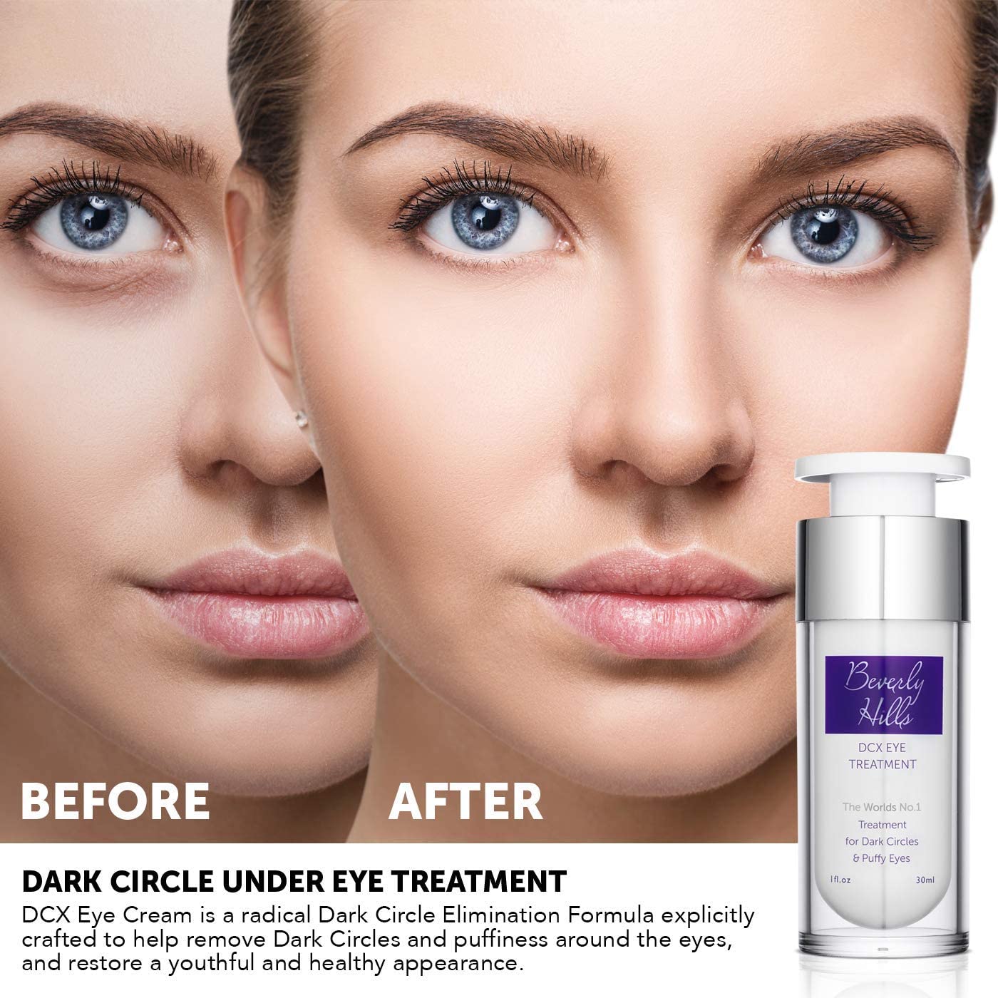 Beverly Hills DCX Dark Circle & Puffy Eye Treatment 1oz / 30ml, White, 30 ml (Pack of 1) - Image 4