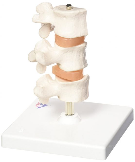 3B Scientific Deluxe Osteoporosis Model 3 Vertebrae + free anatomy software - 3B Smart Anatomy - Image 2