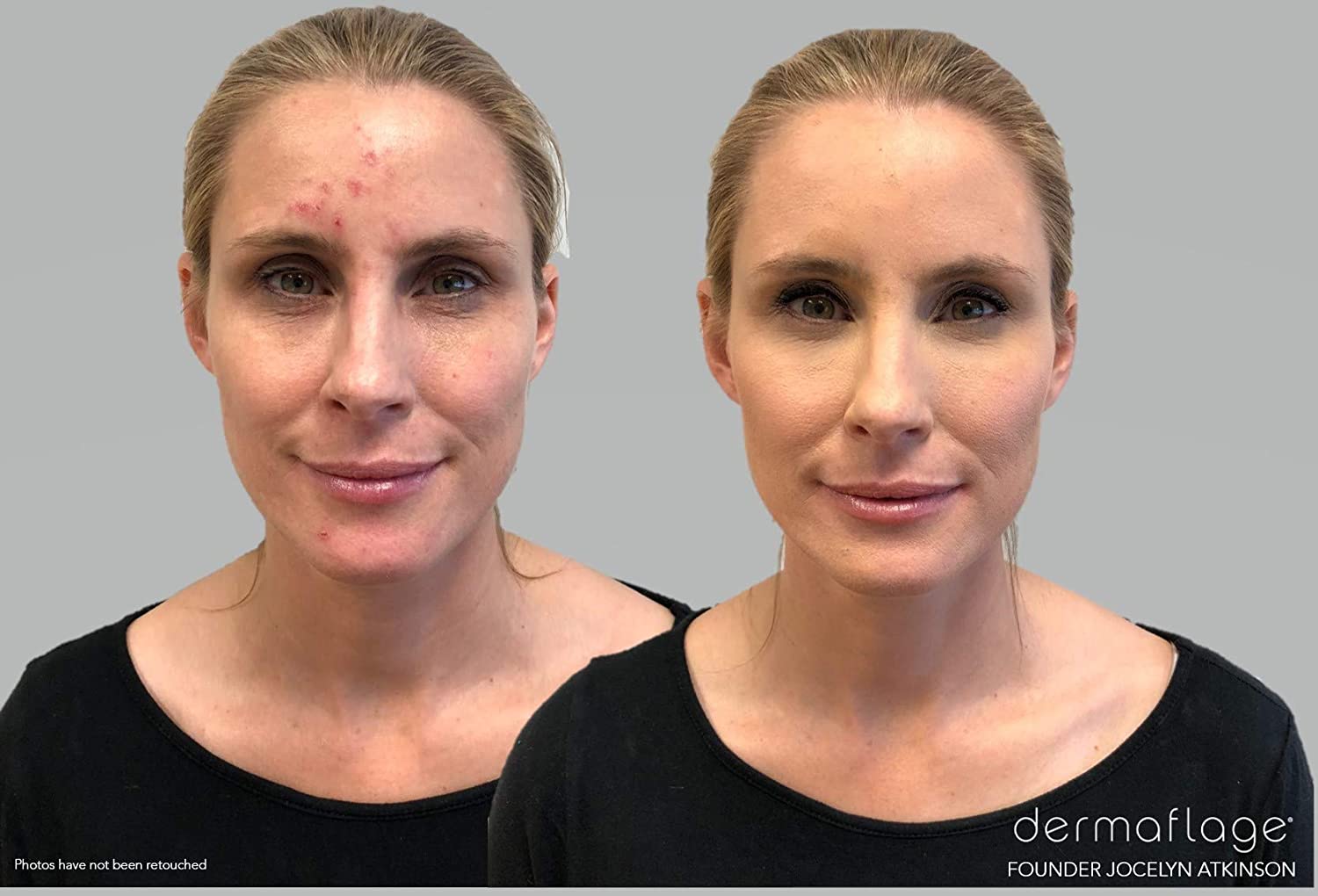 Dermaflage Waterproof Concealer Cream (Fair), Concealer Full Coverage, Matte Finish for Face & Body, Hides Dark Circles - Image 2